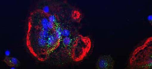 © AG für Proteomik (Prof. Hoflack): Osteoclasten (große, vielkernige Zellen) bauen eine künstliche Knochenoberfläche ab. Die kleinen einkernigen Zellen sind ihre Vorläuferzellen. Das Aktin-Zytoskelett ist rot gefärbt, interne Membrankompartimente grün.