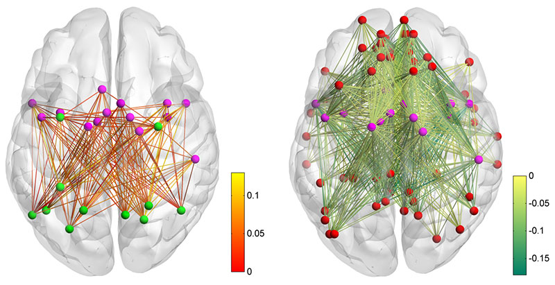 © Holger Mohr et al.; Zunehmende Kommunikation zwischen dem cingulo-opercularen Netzwerk und dem dorsalen Aufmerksamkeitsnetzwerk (links), und die Entkopplung des Ruhezustandsnetzwerks vom cingulo-opercularen Netzwerk (rechts) während kurzer Übungsphasen.