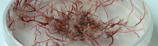 © Institut für Lebensmittel- und Bioverfahrenstechnik; Agarplatte mit Hairy roots von Beta vulgaris (Rote Beete)
