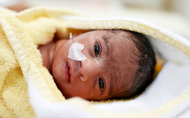 ©  DSKN; Jedes zehnte Neugeborene kommt zu früh auf die Welt und jedes fünfte Neugeborene wird durch Kinderärzte stationär behandelt. Die DSKN engagiert sich mit zahlreichen Projekten für eine optimale und langfristige Versorgung.
